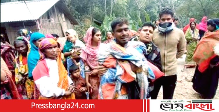 নড়াইলে নানা বাড়ি বেড়াতে এসে অগ্নিদগ্ধে শিশুর মৃত্যু