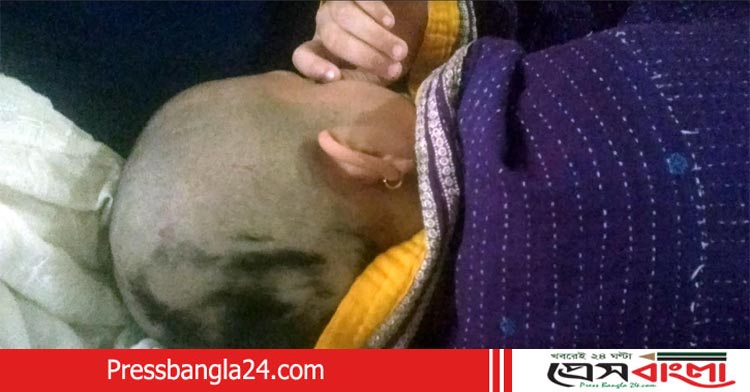 নড়াইলে গৃহবধূ নির্যাতনের ঘটনায় দু’টি মামলায় নানা অসঙ্গতি ! শ্বশুর-শাশুড়ির জামিন
