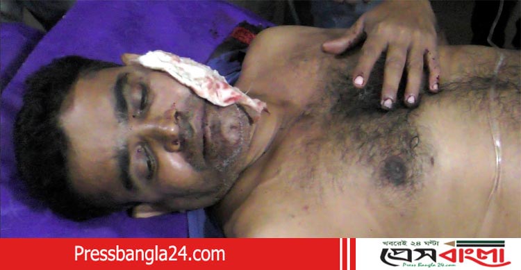 নড়াইলে ইউনিয়ন কৃষকলীগ সভাপতির চোয়ালে গুলি !
