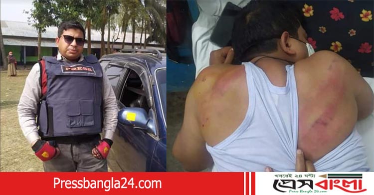 জুয়ার আসরের সংবাদ প্রকাশ করায় সাংবাদিক সুমনের উপর সন্ত্রাসী হামলা